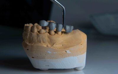 The Top 10 Benefits of Dental Implants for Tooth Replacement