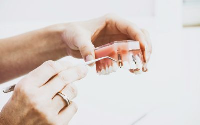 Maintaining Optimal Oral Health: Essential Tips for a Healthy Smile