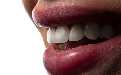 Dental Implants and Osseointegration: What You Need to Know